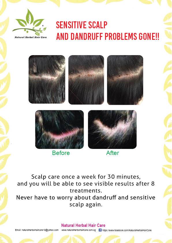 Herbal Therapy - Scalp Tonic 2
