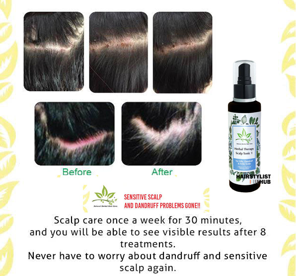 Herbal Therapy Scalp Tonic 1 Before and After photos. Scalp care once a week for 30 minutes, and you will be able to see visible results after 8 treatments