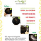 Herbal Therapy - Scalp Tonic 1 before and after photos. Herbal hair coloring prevents hair loss and promotes hair growth