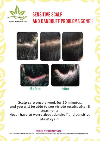 Herbal Therapy - Hair Growth Tonic sensitive scalp and dandruff problems gone