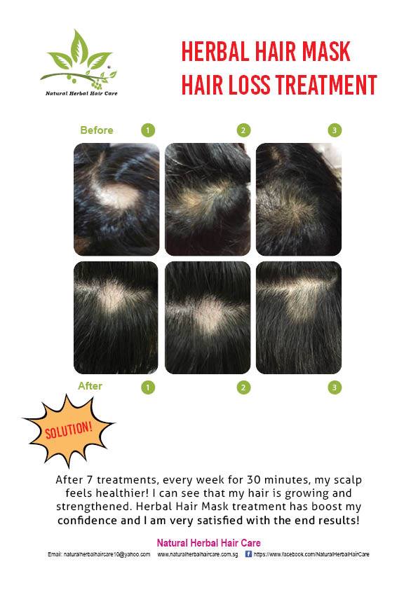 Herbal Therapy - Hair Growth Tonic