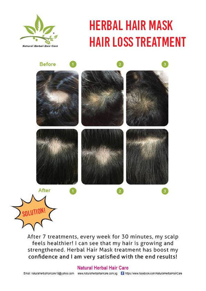 Herbal Therapy - Hair Growth Tonic