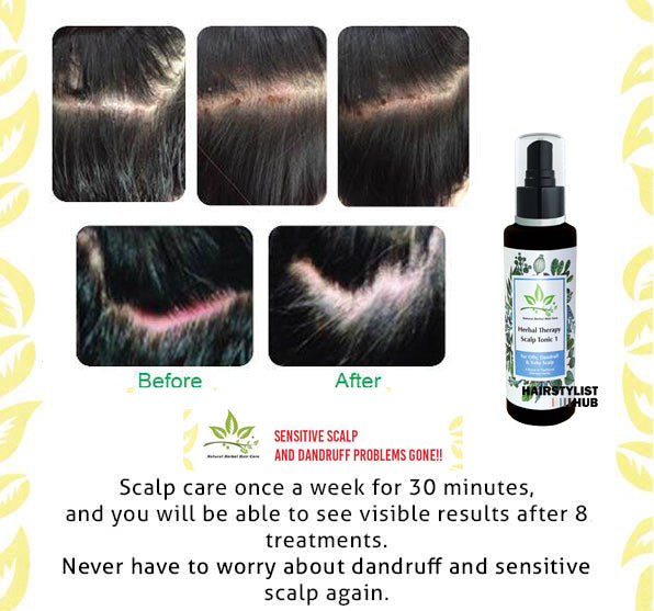 Herbal Therapy Hair Growth Tonic before and after, information, results in a week